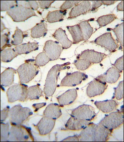 ANTI-DDX60L (C-TERM) antibody produced in rabbit