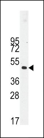 ANTI-DESMIN (T16) antibody produced in rabbit