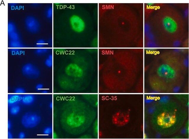 Anti-CWC22 antibody produced in rabbit