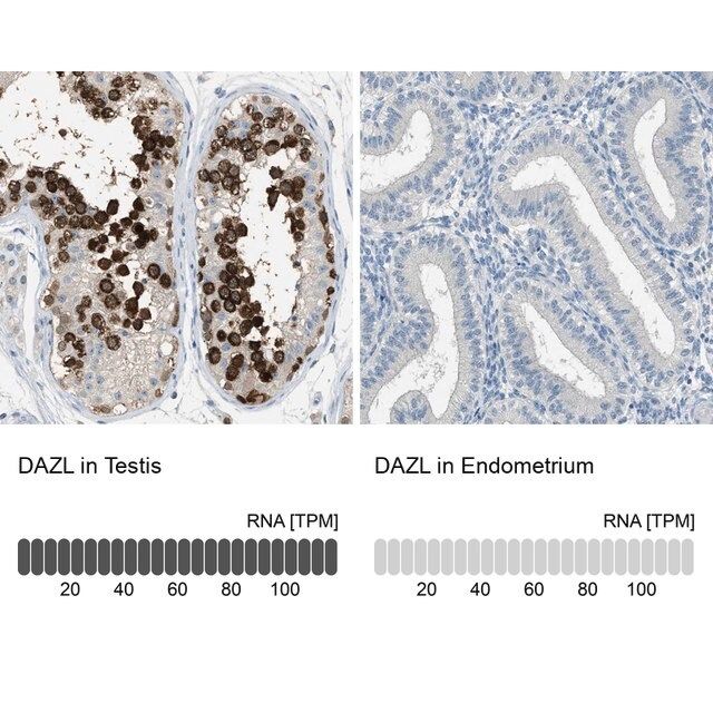 Anti-DAZL antibody produced in rabbit