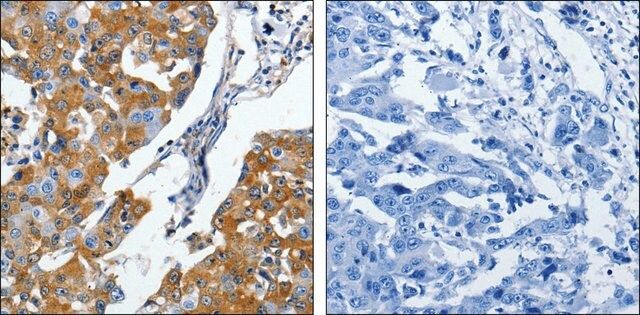 Anti-CRMP5 antibody produced in rabbit