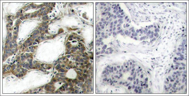 Anti-CTNNB1 (Ab-33) antibody produced in rabbit