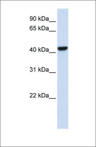 Anti-CTH antibody produced in rabbit