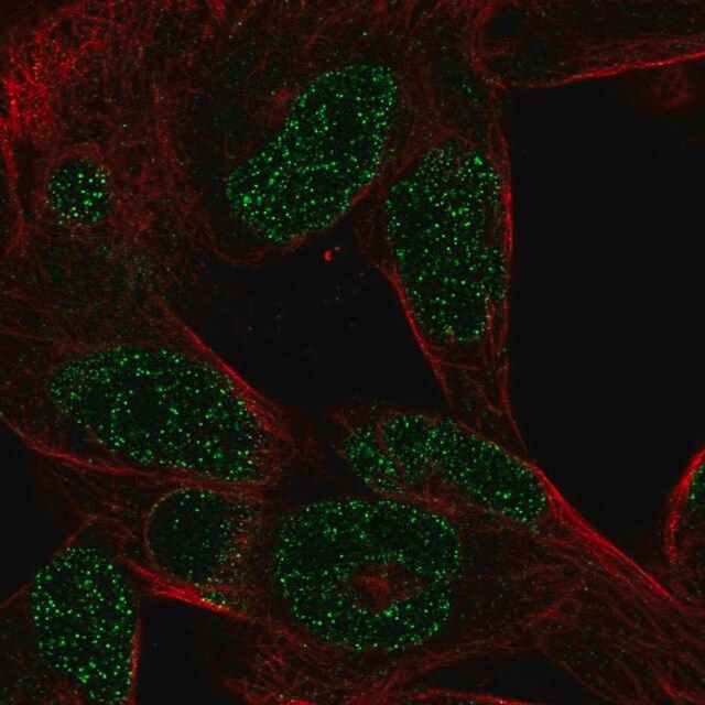 Anti-CTHRC1 antibody produced in rabbit