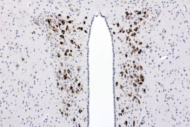 Anti-CTHRC1 Antibody, clone Vli-55