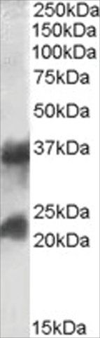 Anti-CTLA and CTLB antibody produced in goat