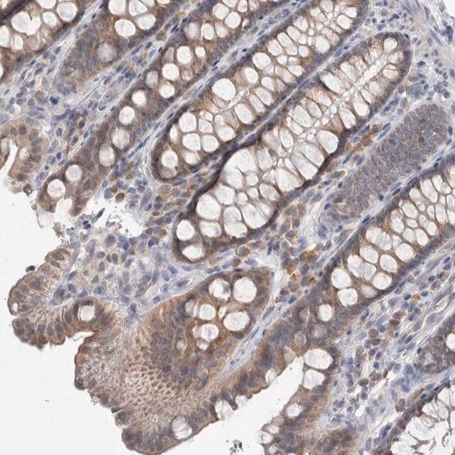 Anti-CUL2 antibody produced in rabbit