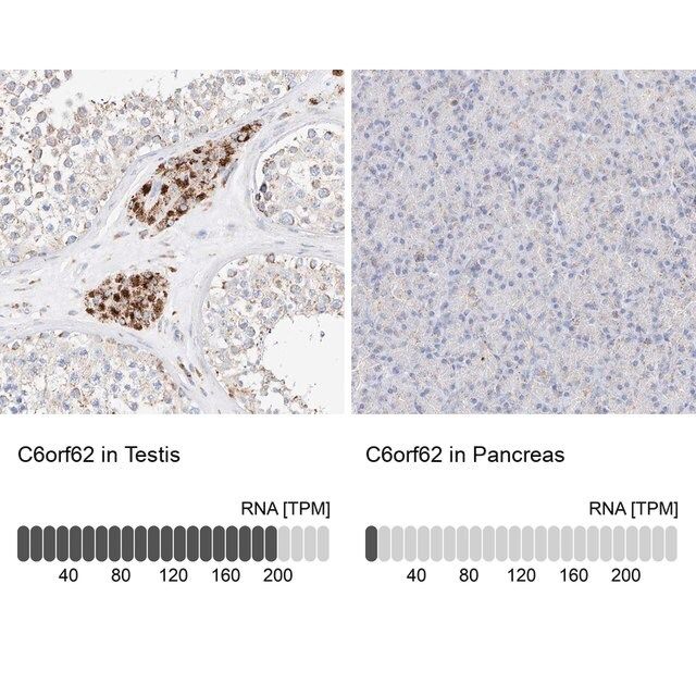 Anti-C6orf62 antibody produced in rabbit