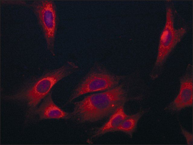 Anti-Coronin-1C (C-terminal) antibody produced in rabbit