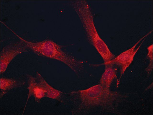 Anti-Coronin 1B antibody produced in rabbit