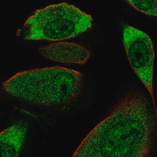 Anti-COL28A1 antibody produced in rabbit