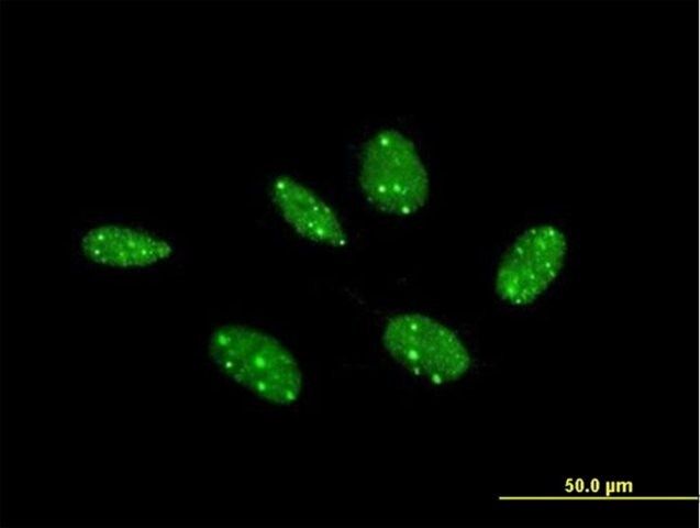 Anti-COIL antibody produced in mouse