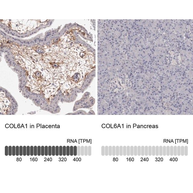 Anti-COL6A1 antibody produced in rabbit