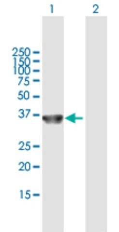 Anti-COL23A1 antibody produced in mouse