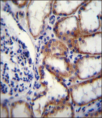 ANTI-COL8A2 (C-TERM) antibody produced in rabbit