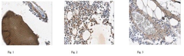 Anti-COL1A2, clone alpha2CT, Azide Free Antibody