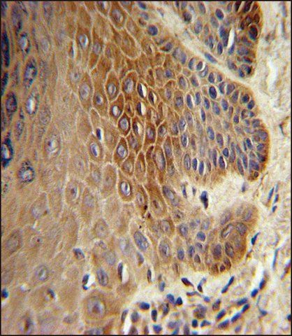 ANTI-COL17A1 (CENTER) antibody produced in rabbit