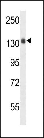 ANTI-COL4A5(N-TERMINAL) antibody produced in rabbit