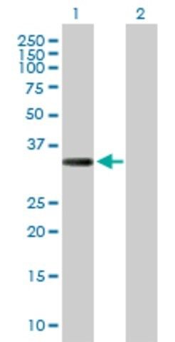 Anti-COL23A1 antibody produced in rabbit