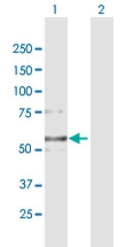 Anti-COL6A2 antibody produced in mouse