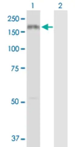 Anti-COL3A1 antibody produced in rabbit