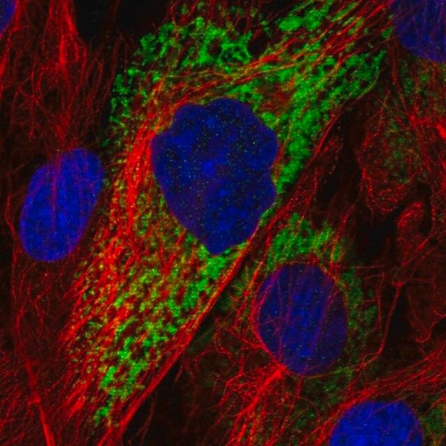 Anti-COL11A1 antibody produced in rabbit