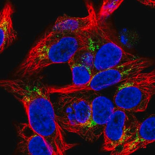 Anti-COL18A1 antibody produced in rabbit