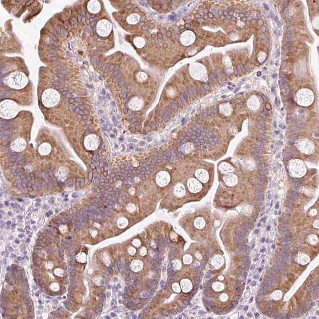 Anti-COL9A2 antibody produced in rabbit