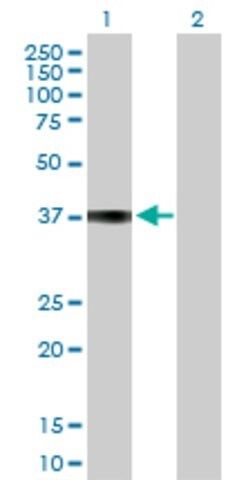 Anti-COL9A1 antibody produced in rabbit