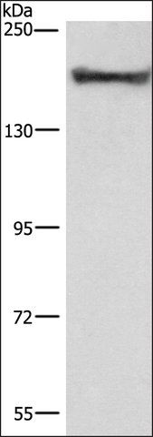 Anti-COL4A2 antibody produced in rabbit