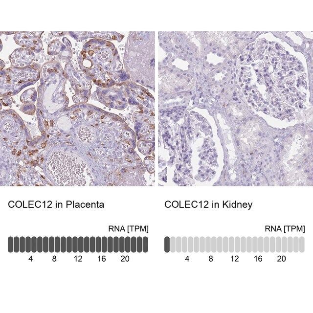 Anti-COLEC12 antibody produced in rabbit