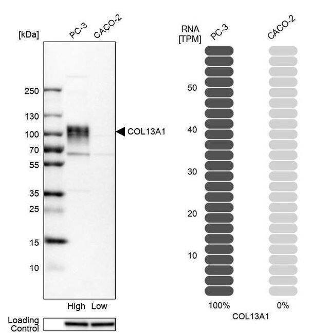 Anti-COL13A1 antibody produced in rabbit