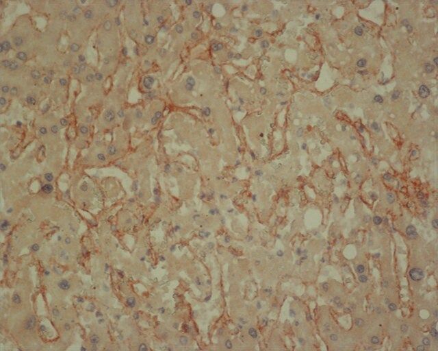 Anti-Collagen IV antibody, Mouse monoclonal