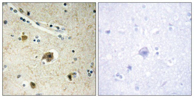 Anti-Collagen IV 4 antibody produced in rabbit