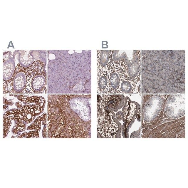 Anti-COL6A2 antibody produced in rabbit