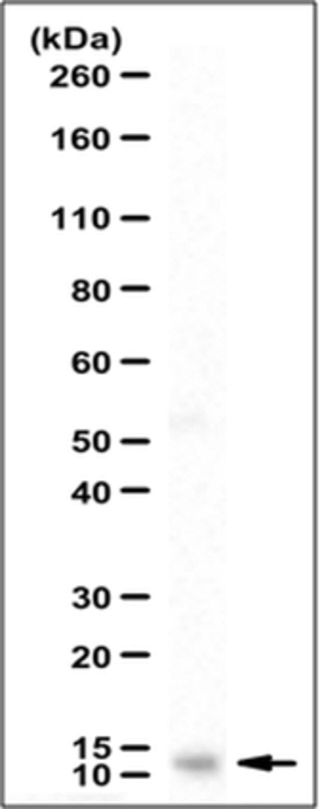 Anti-Colipase Antibody