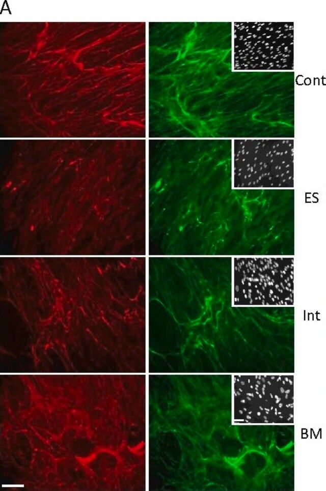 Anti-Collagen Type VI Antibody, clone 3C4