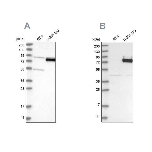 Anti-COLGALT2 antibody produced in rabbit