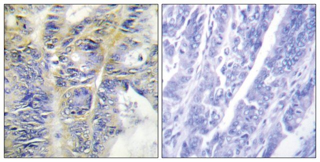 Anti-Collagen IV 5 antibody produced in rabbit