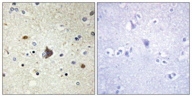 Anti-Collagen IV 3 antibody produced in rabbit