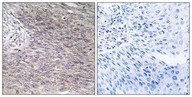 Anti-CHSY2, C-Terminal antibody produced in rabbit