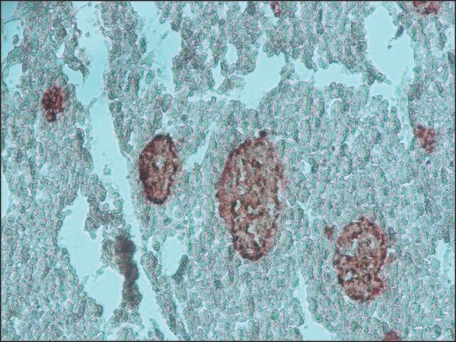 Anti-Chromogranin A antibody produced in rabbit