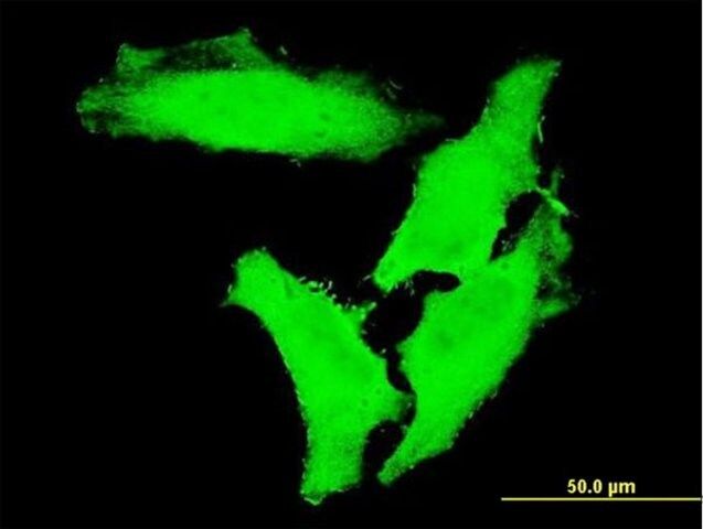 ANTI-CHUK antibody produced in mouse