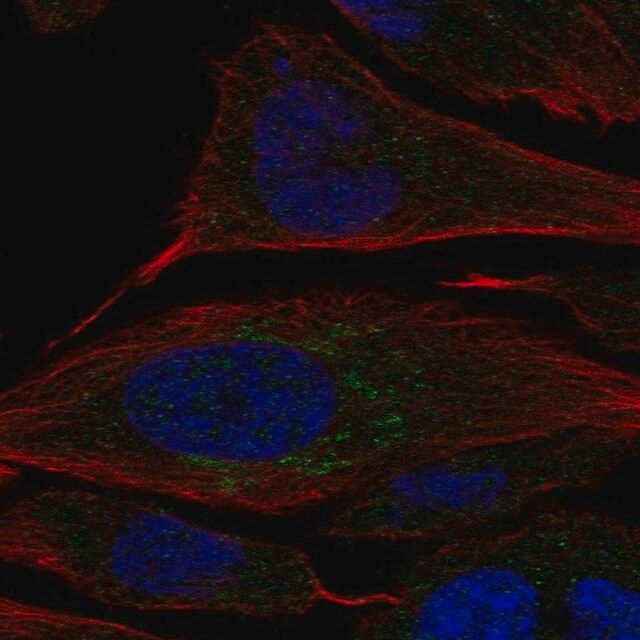 Anti-CHST2 antibody produced in rabbit