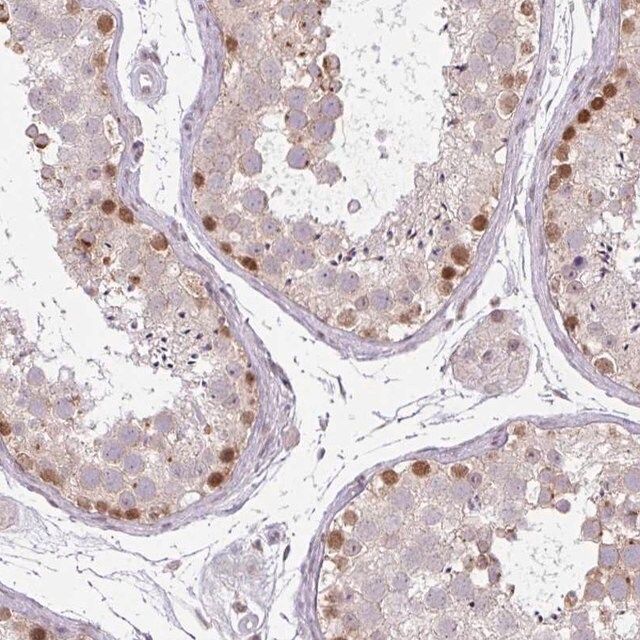 Anti-CHTF8 antibody produced in rabbit