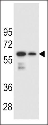 ANTI-CHST3(N-TERMINAL) antibody produced in rabbit