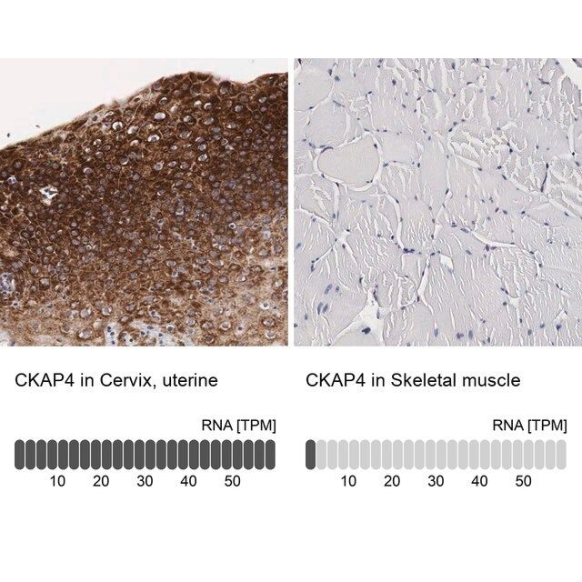 Anti-CKAP4 antibody produced in rabbit