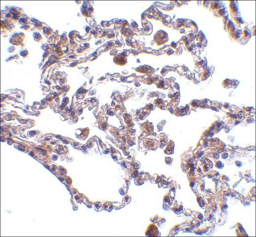 Anti-CIKS antibody produced in rabbit