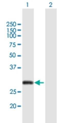 Anti-CITED2 antibody produced in mouse