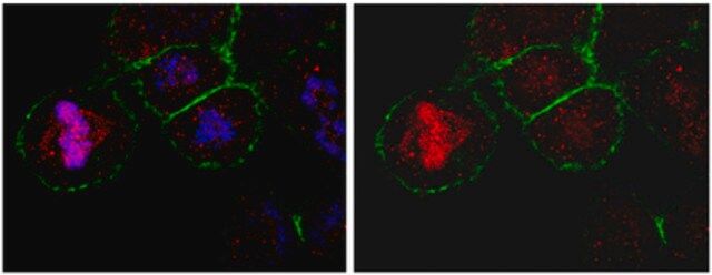 Anti-CKAP5 Antibody